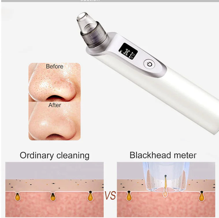 Pore Cleanser Ultrasonic Blackhead Remover Device